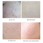 AICHUN BEAUTY Salicylic Acid Purifying Shrink Pores Exfoliation Anti-Acne Face Serum - 30ml